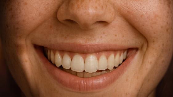microbiome buccal