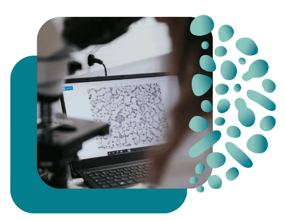 pourquoi tester microbiome buccal